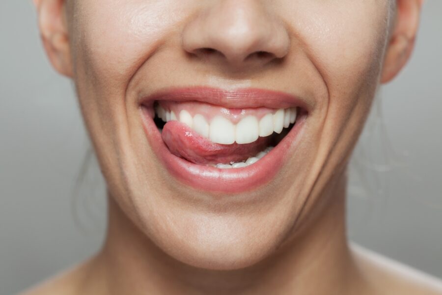 Close-up view of a bright, healthy smile highlighting natural-looking teeth restored with dental bridges, designed to replace missing teeth and improve function and confidence – dental bridges