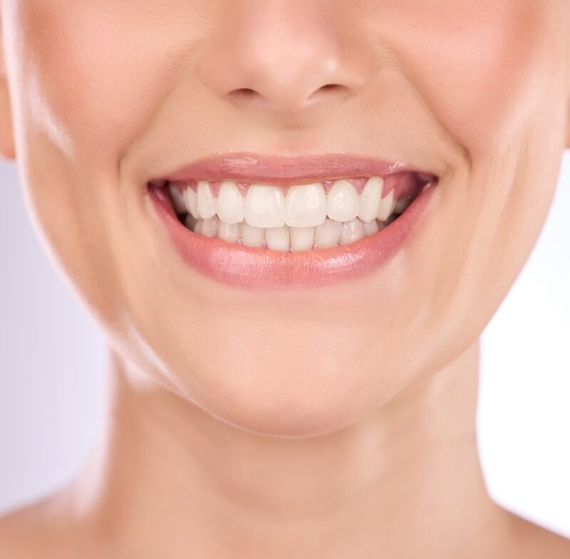 Close-up of a healthy, radiant smile showcasing implant restoration, designed to restore missing teeth with natural appearance, strength, and long-lasting function – implant restoration