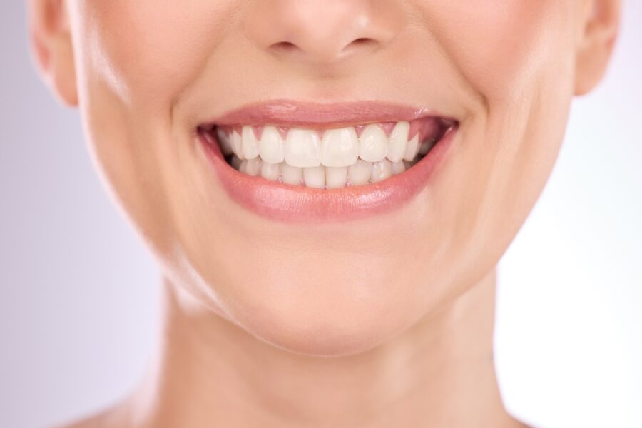 Close-up of a healthy, radiant smile showcasing implant restoration, designed to restore missing teeth with natural appearance, strength, and long-lasting function – implant restoration